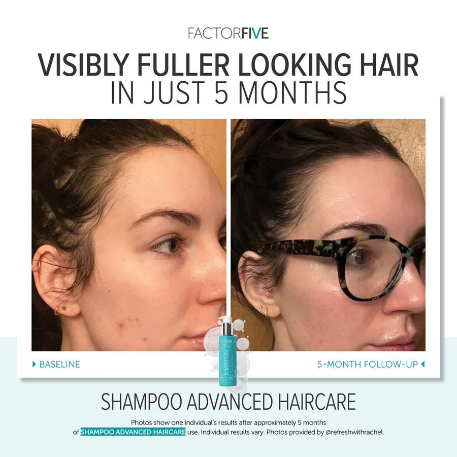 factorfive-advanced-haircare-shampoo-after-2.webp