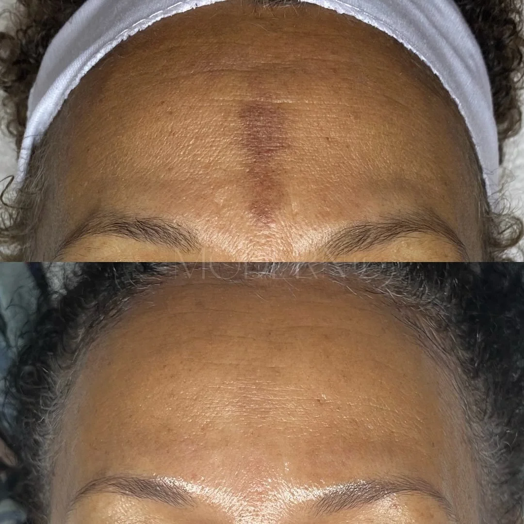 It&rsquo;s never too late to start taking better care of your skin. It is constantly regenerating itself, ready to begin again whenever you are, shedding the pieces of us that no longer fit into the story of who we want to become. 

I love love lovee