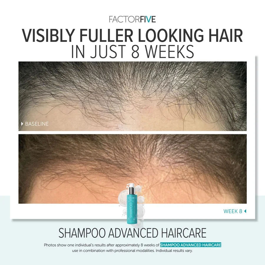factorfive-advanced-haircare-shampoo-after-4.webp