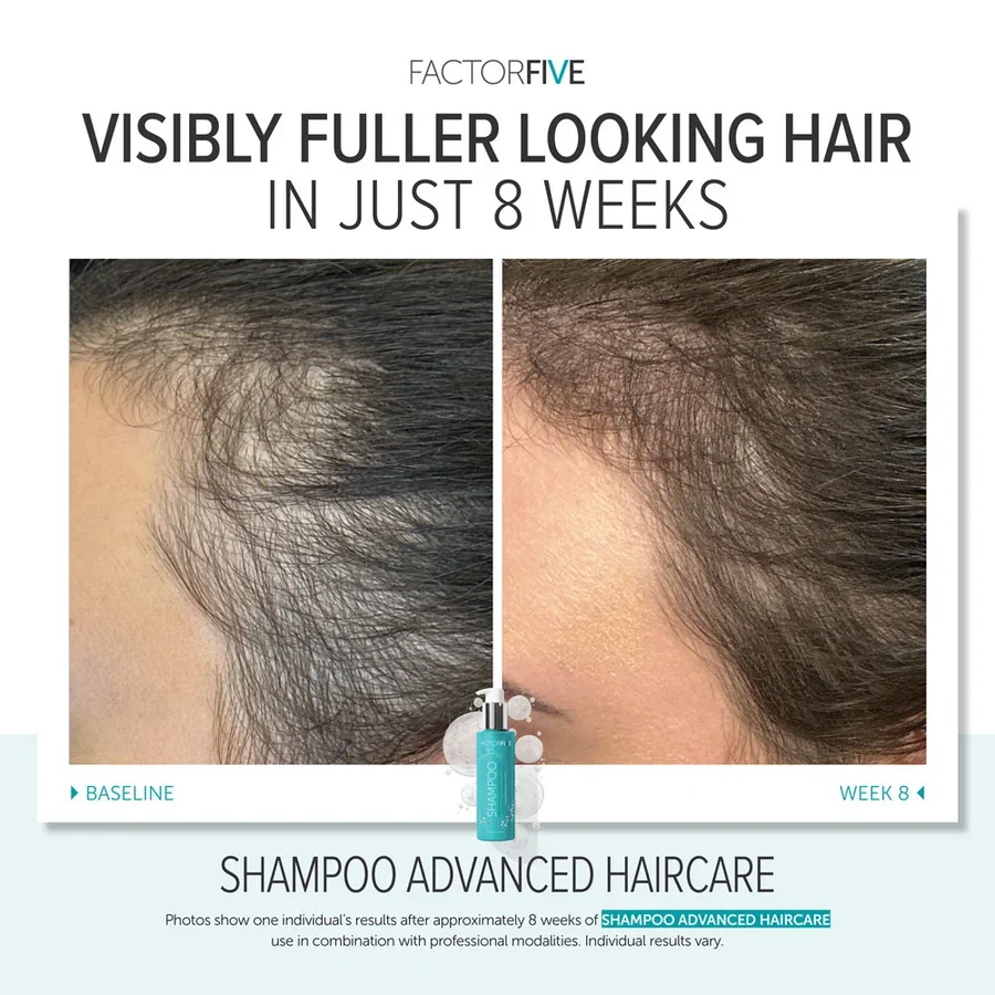 factorfive-advanced-haircare-shampoo-after-1.webp