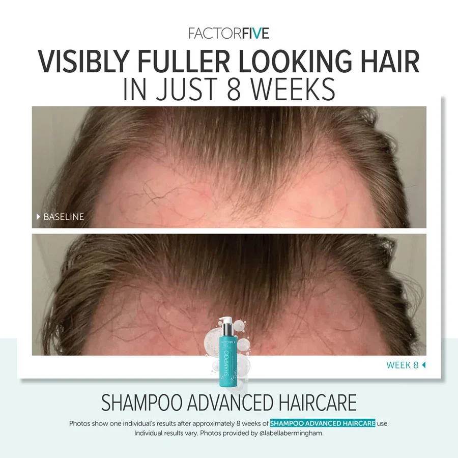 factorfive-advanced-haircare-shampoo-after-3.webp