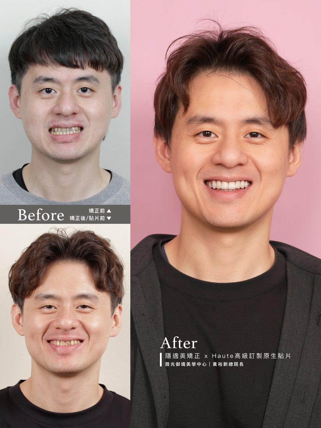 從不敢笑，到笑得帥氣又有自信