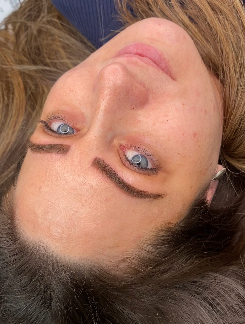 Old brow correction