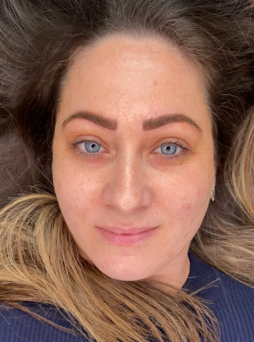 Healing Process for Brows, Lips, Eyes, and Stretch Marks Ella Fjord