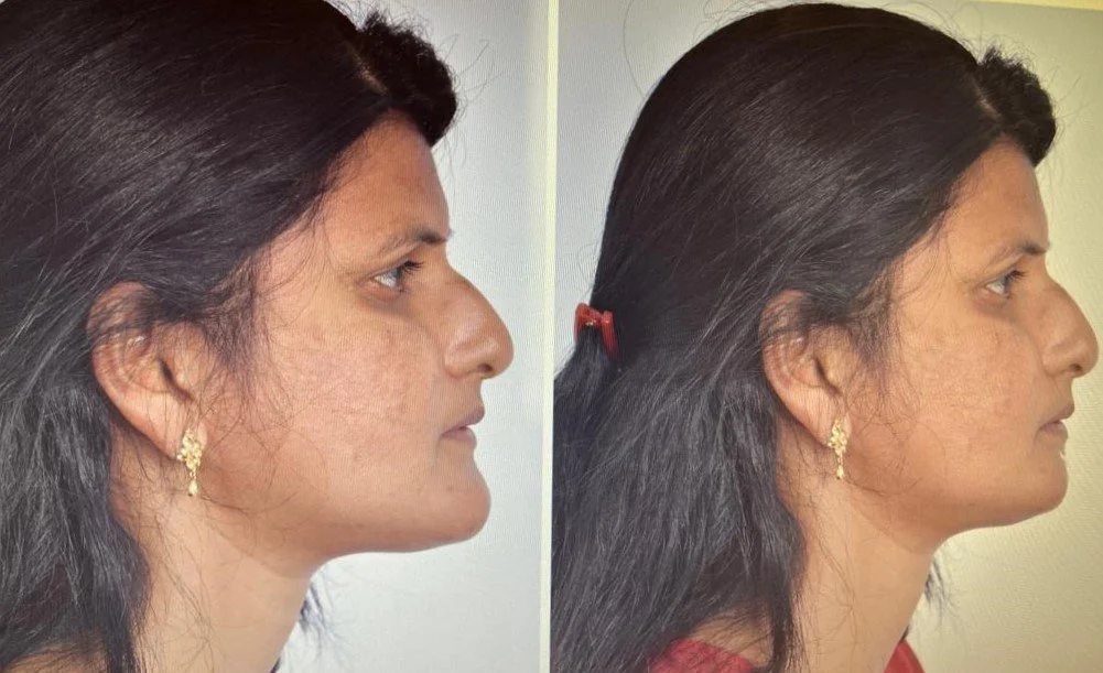 3D surgical planning