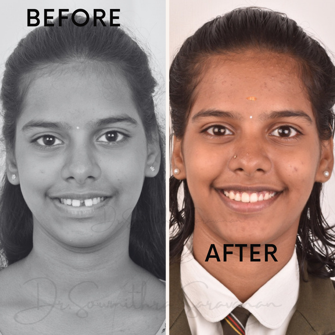 transformation - 1.PNG