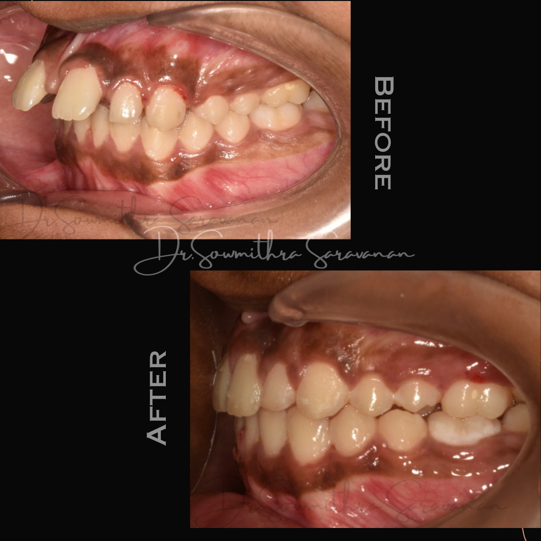 transformation - 4.PNG