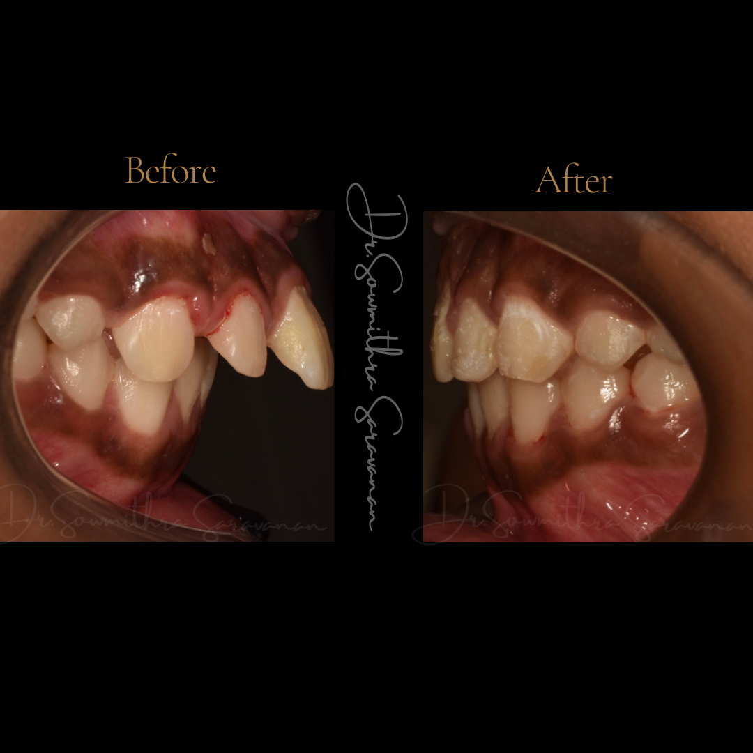 transformation - 6.PNG