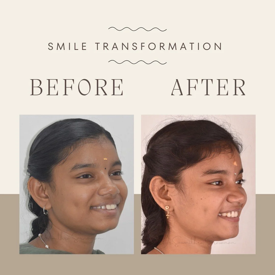 Smile transformation - 2.jpg