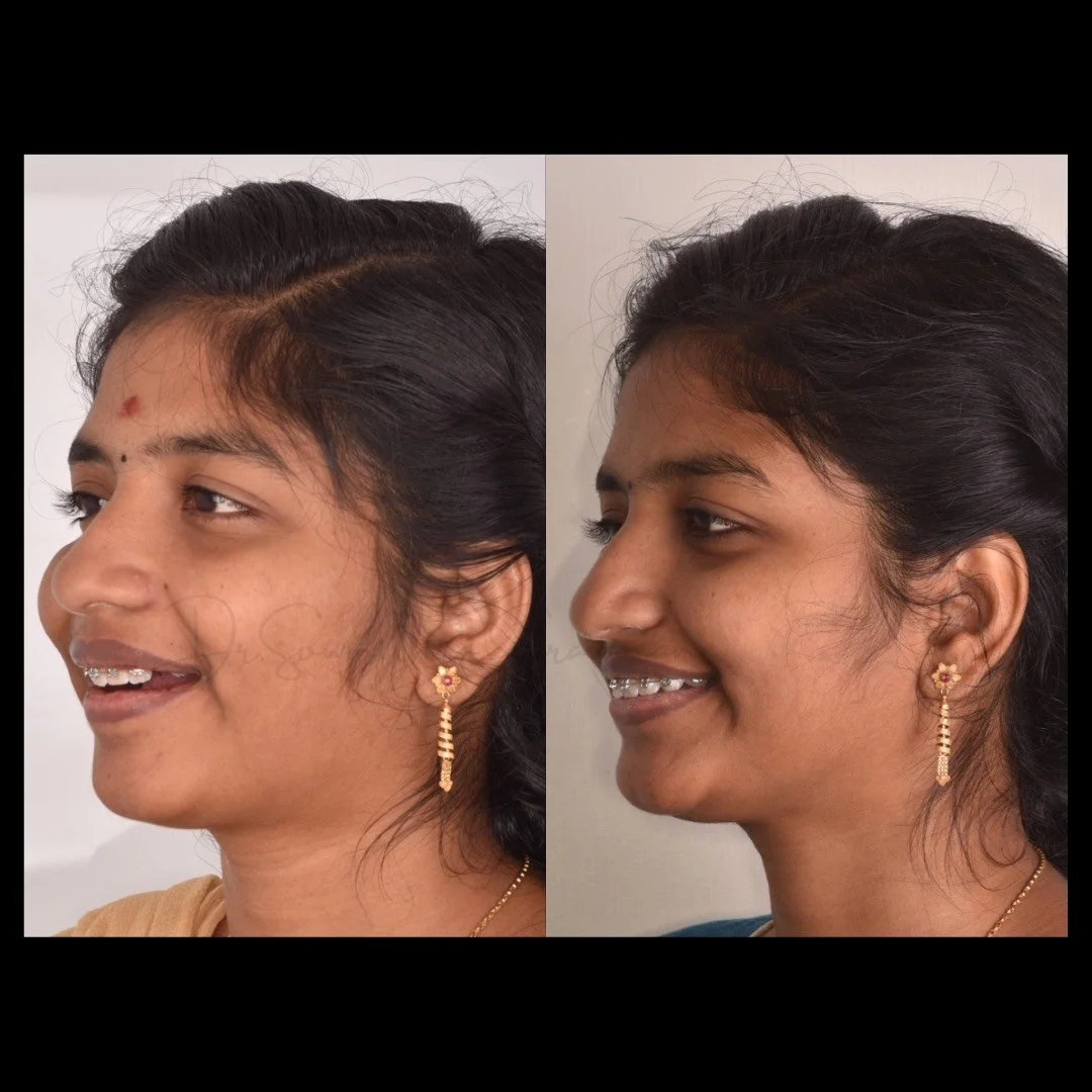 Dr.Sowmithra Saravanan - 3.jpg