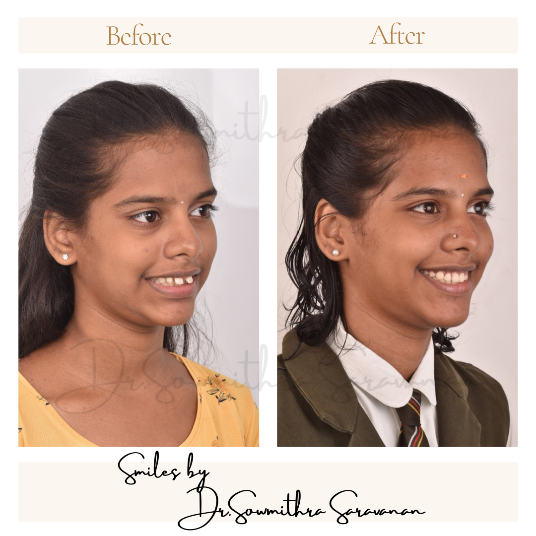 transformation - 5.PNG