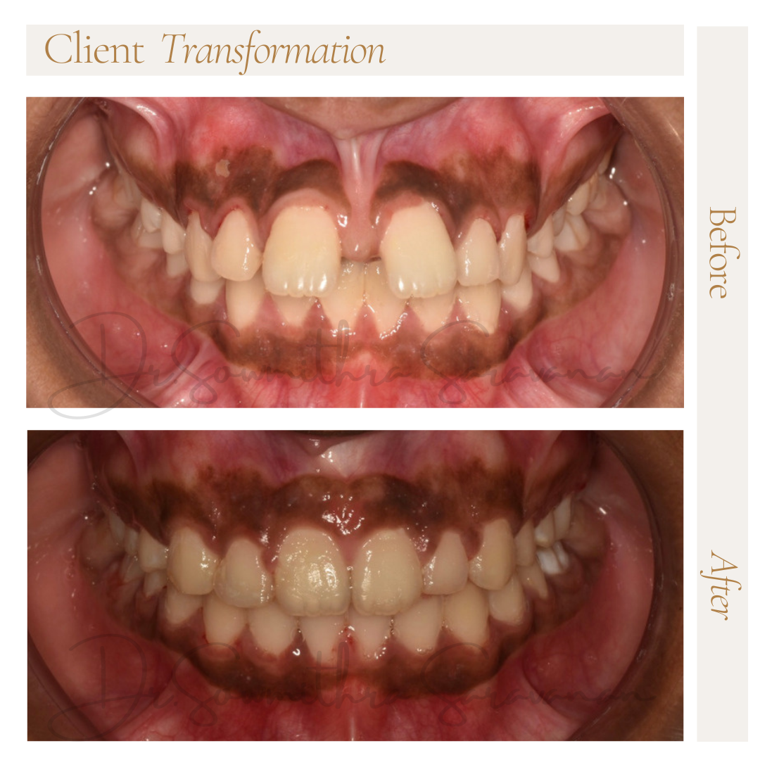 transformation - 2.PNG