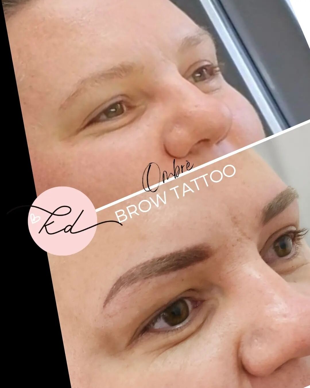 ✨️ Ombr&egrave; Brow Tattoo - before &amp; after ✨️

Healed brows will fade in colour by about 30% and the tattoo itself will shrink and not be the size as tattooed. 
Once healed, brows look natural due to pixelation and fading while matching your fe