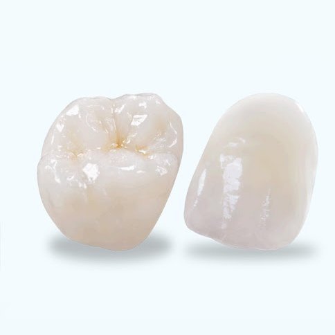 crowns-1.jpg