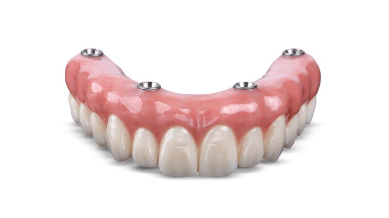 Aesthetic implant prosthesis-products-1.jpg