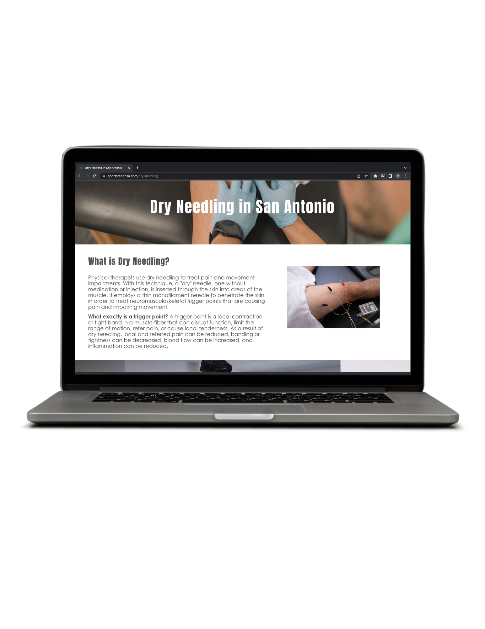 Product Page - Marketing Agency - Sports Rehab