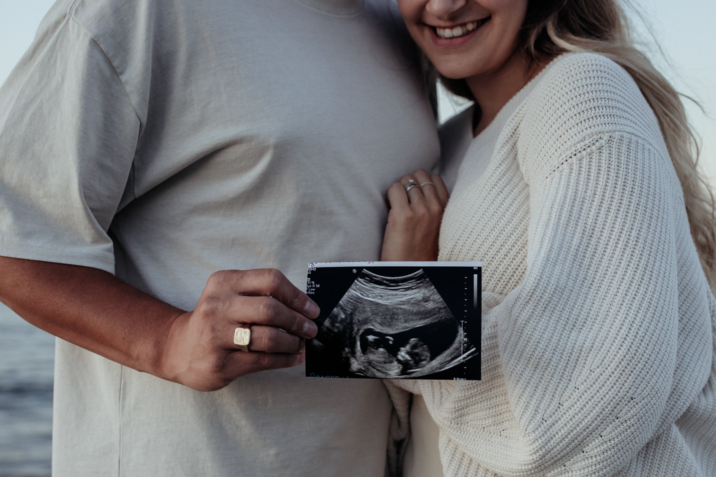 New Zealand maternity photoshoot with expectant parents holding ultrasound.