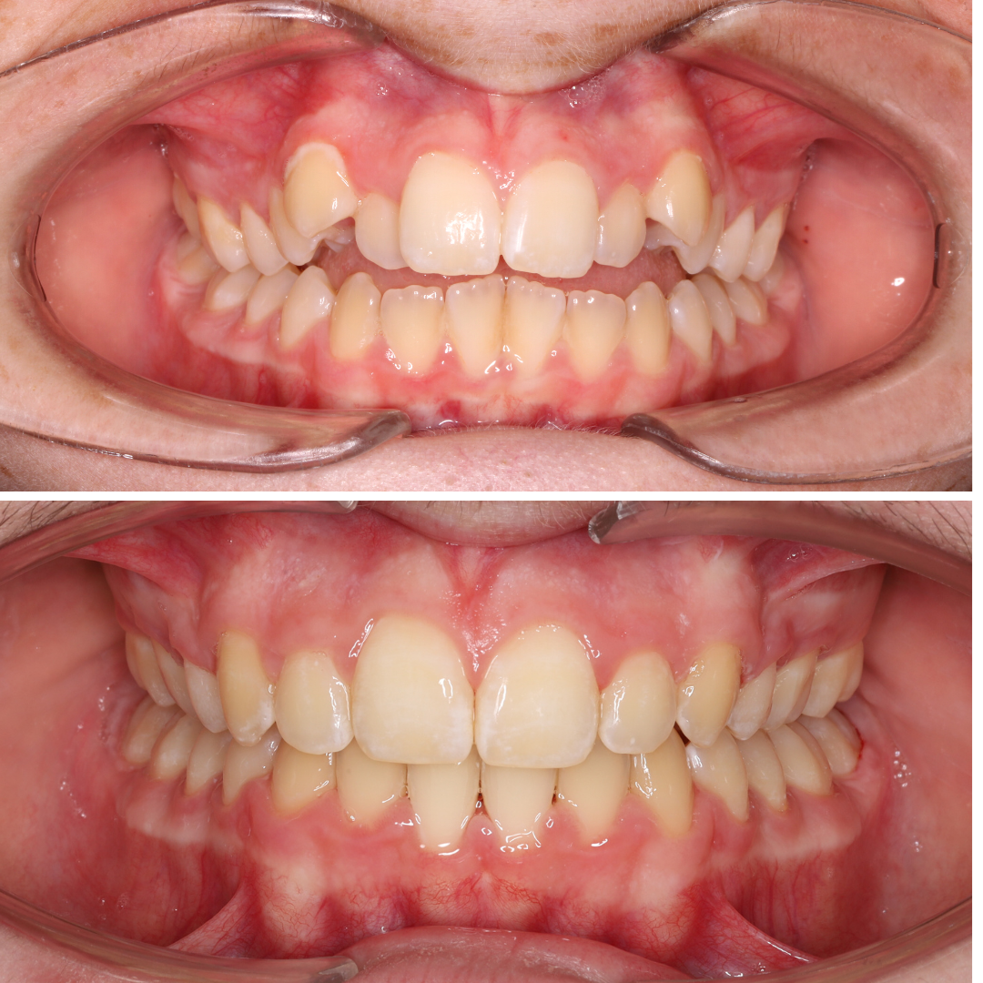 Charlie Dunne website.png