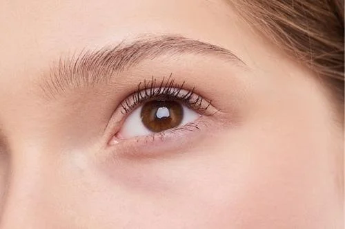 TEAR TROUGH filler, eye bags, under eye, tired look