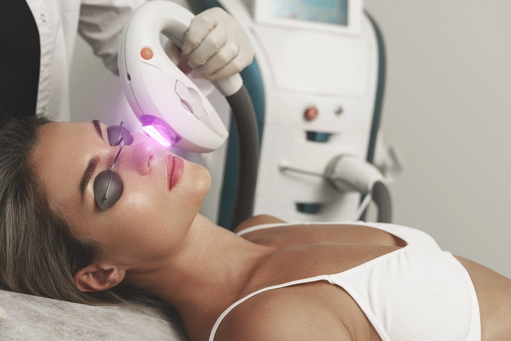 woman getting IPL in Landisville PA