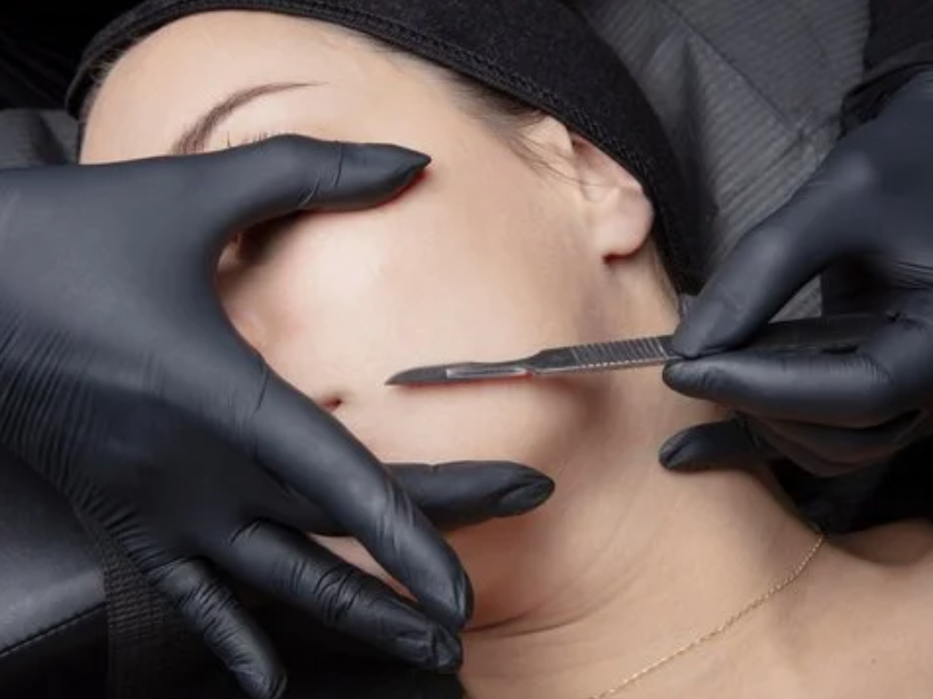 dermaplaning skincare in Landisville PA