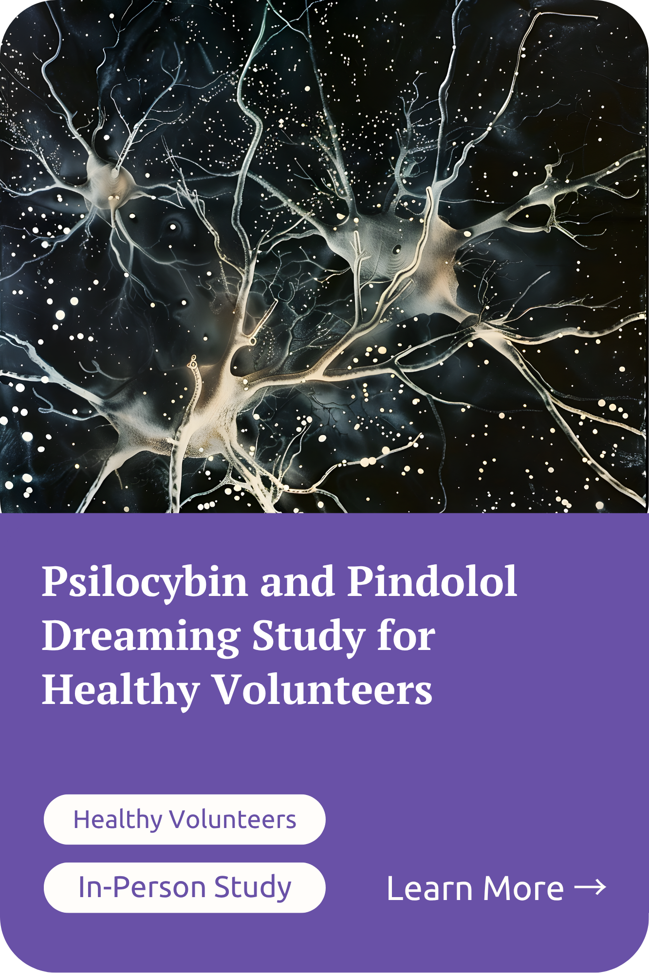 Study Cards - Psilblock.png