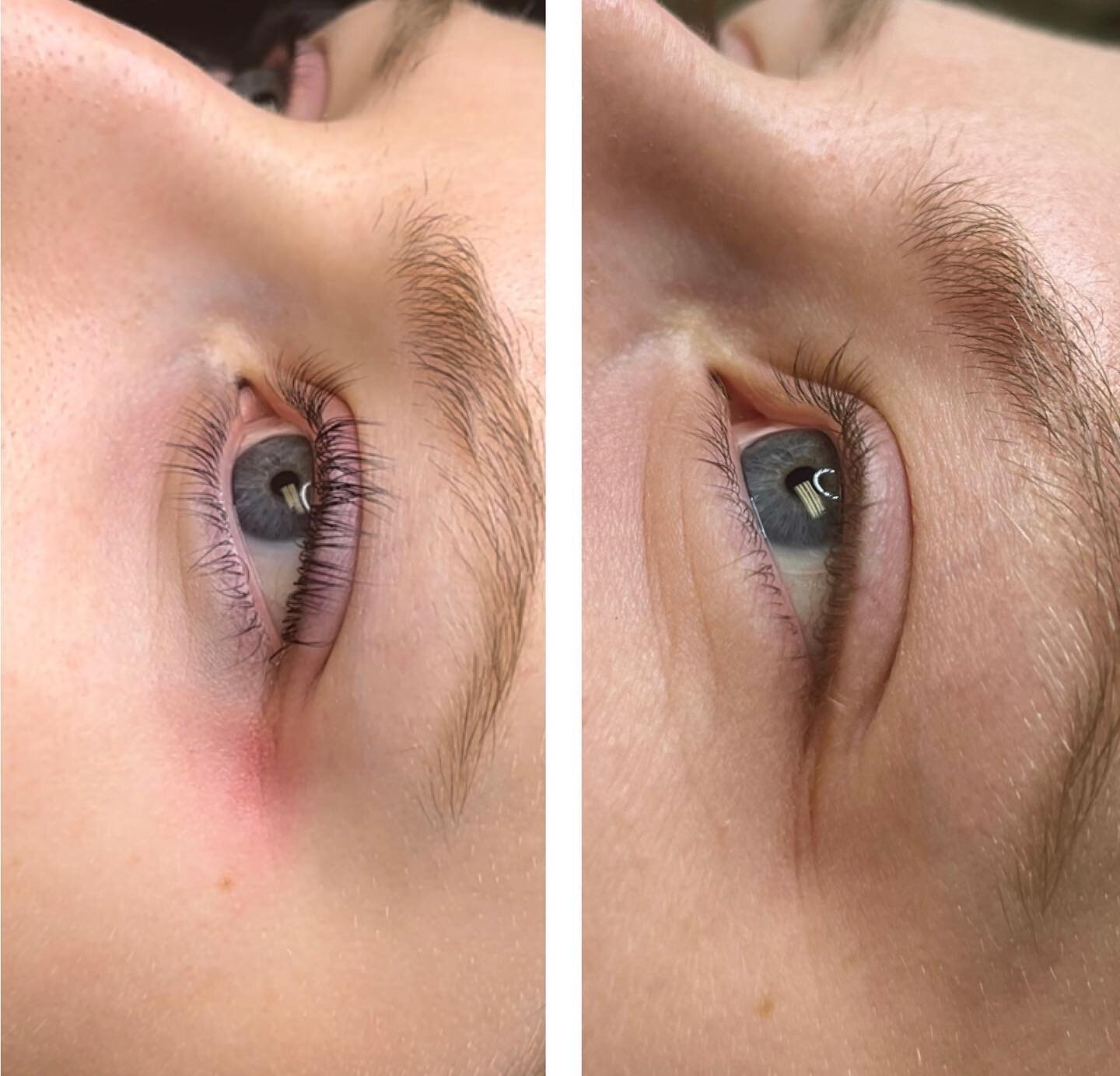 ⭐️ Before + After Lash Lift by @kellsesthetics ⭐️

Come see Kelly Thursday (4/13) in West Ashley to receive 20% off your brows!! *must mention this post to redeem* 

Call or book online 🌿

#getwaxed #brows #browwax #lashlift #chs #chsspringbreak #sp