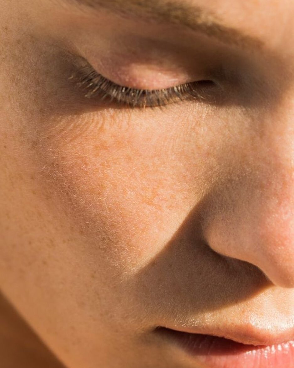 The skin barrier, also known as the epidermal barrier or the stratum corneum, is a protective layer of the skin that helps to keep the skin hydrated and prevent damage from external factors like bacteria, pollutants, and UV radiation. The skin barrie