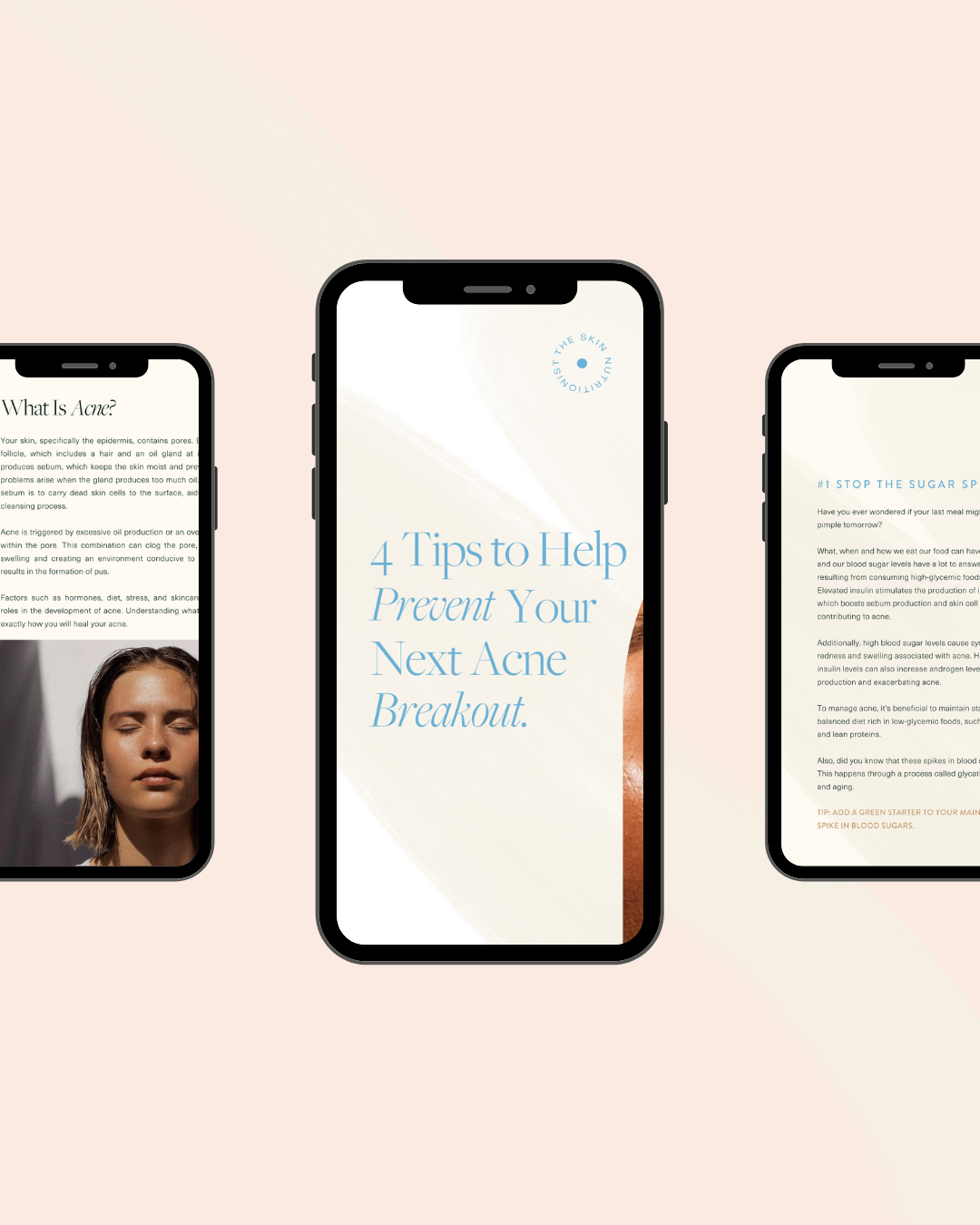 4 tips to prevent your next acne breakout template .png