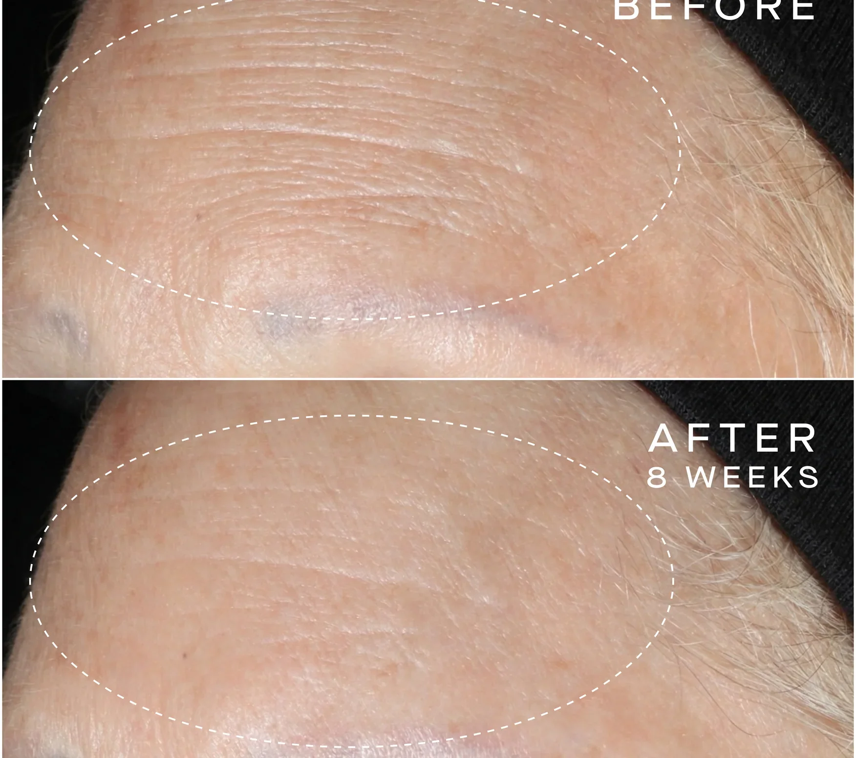 Ourself_ARS-Before_After-PDP-03_876x776_crop_center@2x.webp
