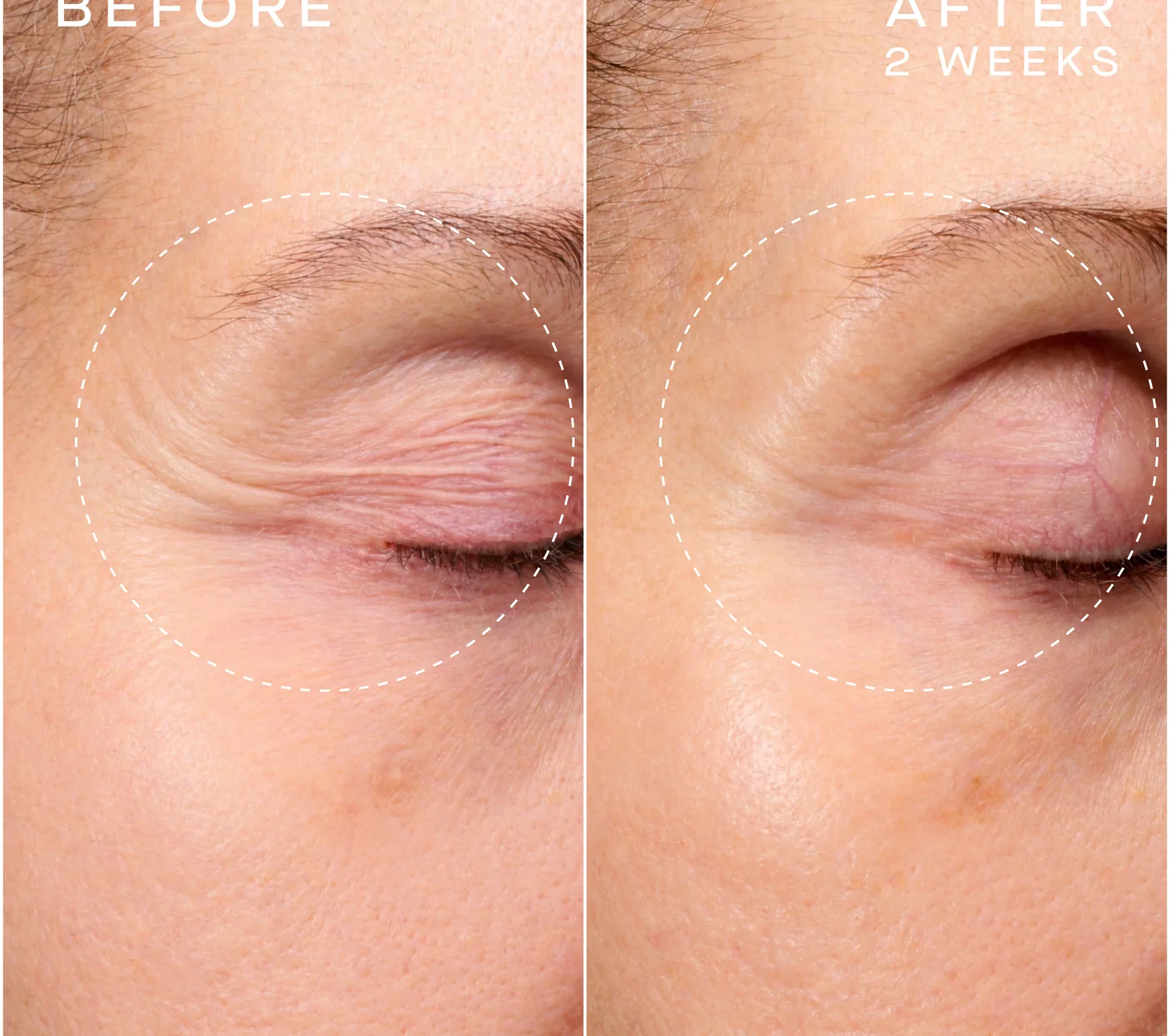 Ourself_ARS-Before_After-PDP-01_876x776_crop_center@2x.webp
