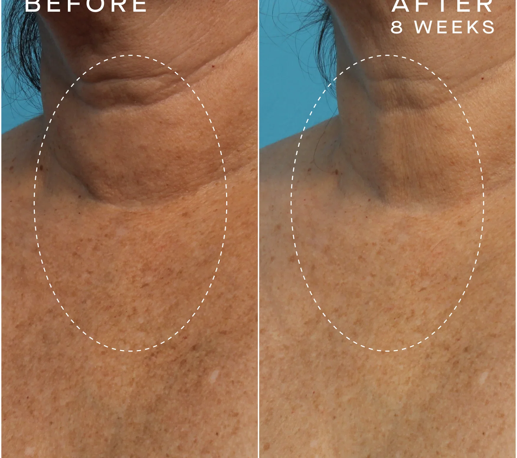 Ourself_ARS-Before_After-PDP-05_876x776_crop_center@2x.webp