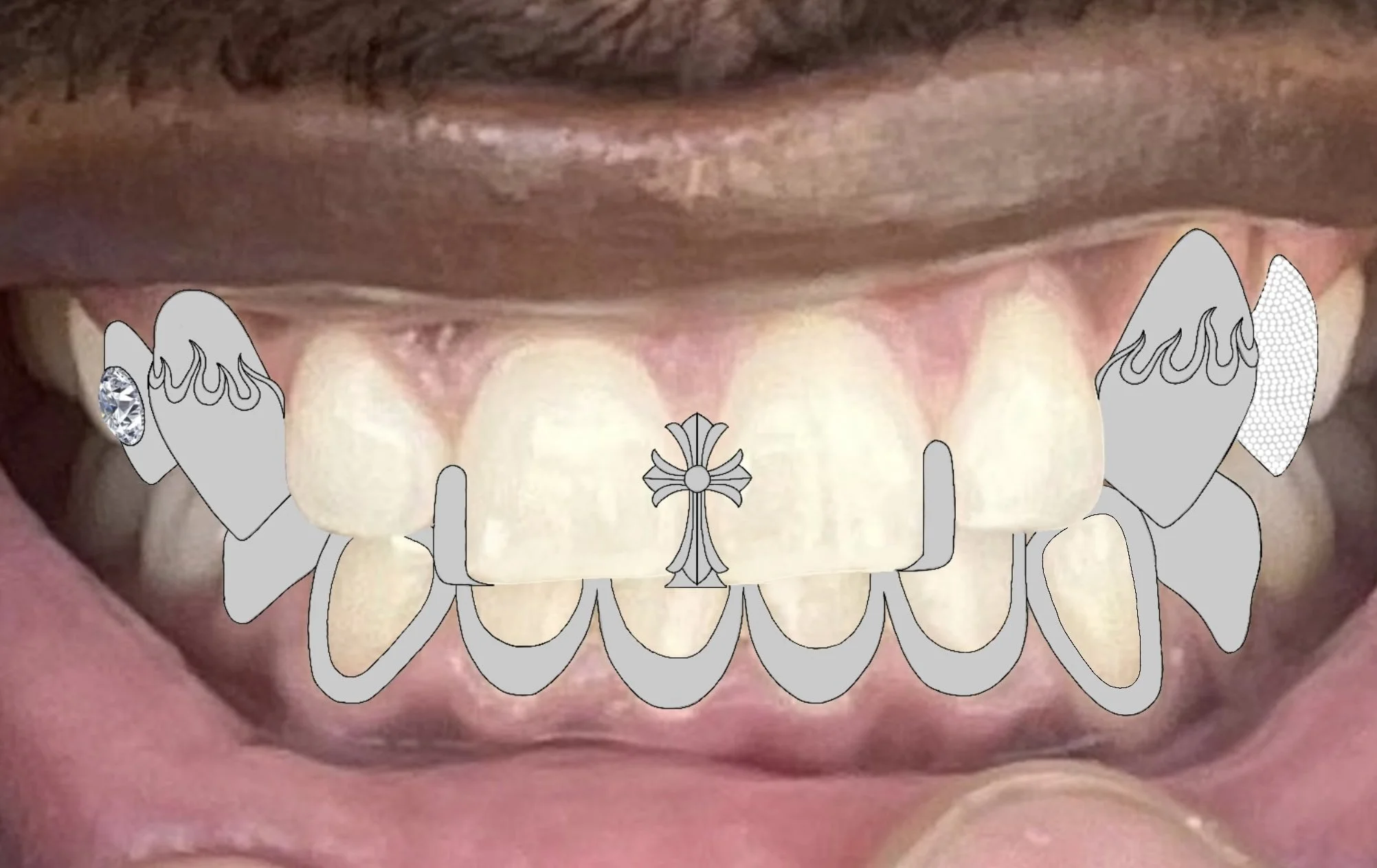 Close-up of teeth with a graphic overlay showing a decorative dental grill or jewelry across the front teeth, with intricate designs including a gemstone on one side and a central ornamental piece.