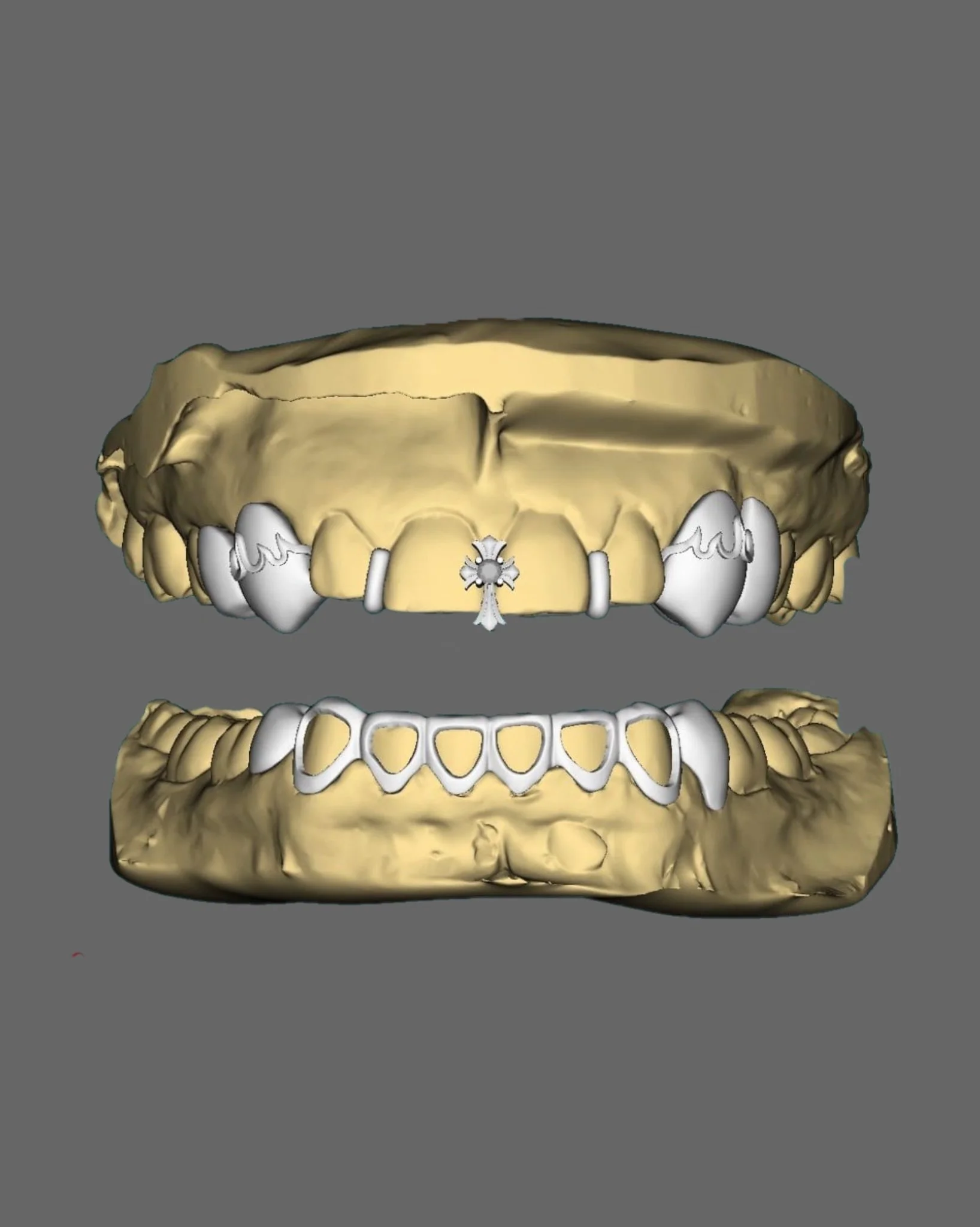 Digital 3D rendering of a set of human teeth and jawbones with dental crowns and a decorative cross pendant.