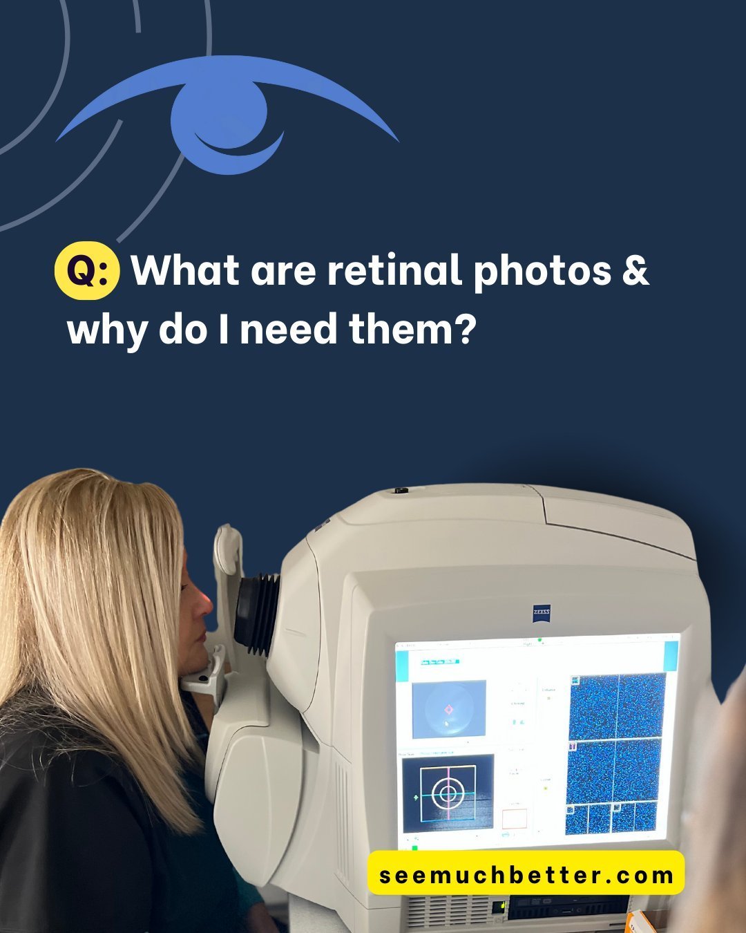 Q: What are retinal photos and why do I need them?
A: The retina is the cellophane-thick layer in the back of the eye composed of rods and cones that is responsible for sending light images to the brain for processing what we experience as vision. Re