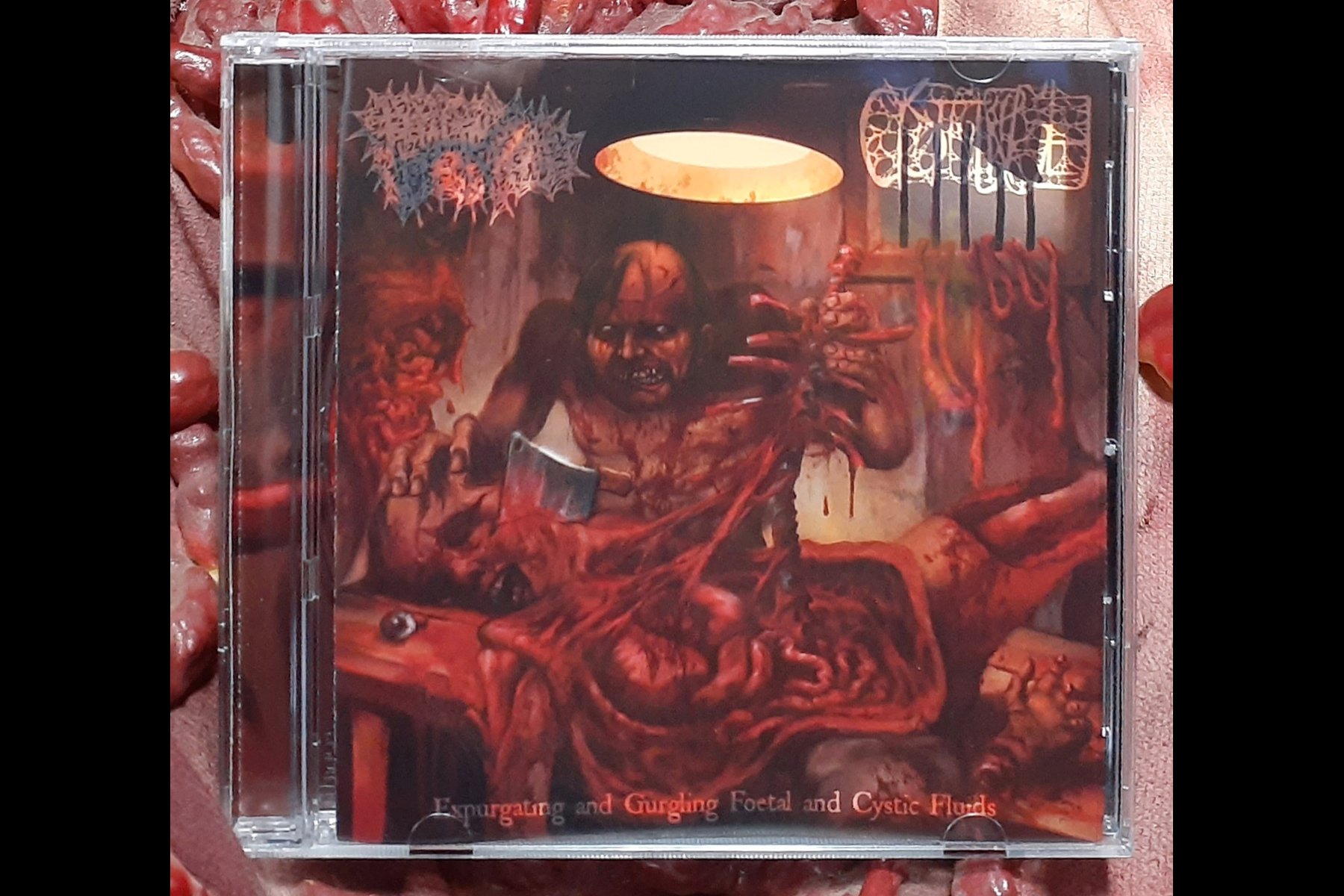 CYSTGURGLE FOETAL FLUID TO EXPURGATE SPLIT CD.jpg