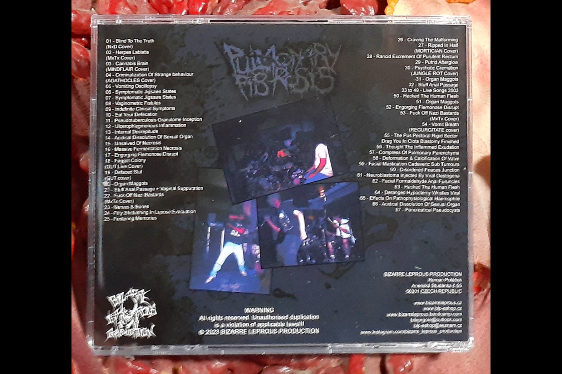 PULMONARY FIBROSIS – Nasal Nauseous Vomit Liquid Goregrind History Volume 3 CD BACK.jpg