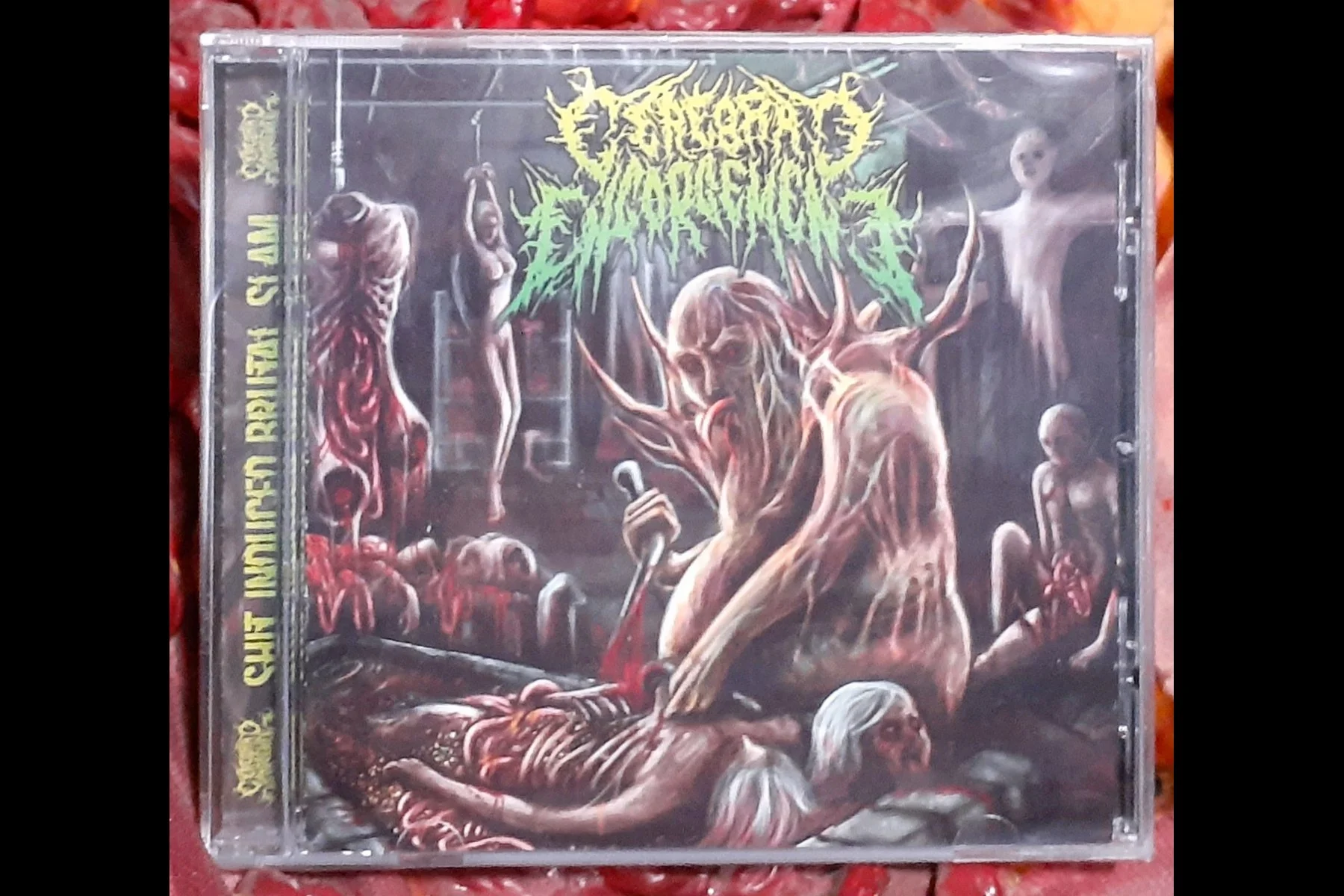 CEREBRAL ENGORGEMENT - Gastrointesnal Bleeding CD.jpg