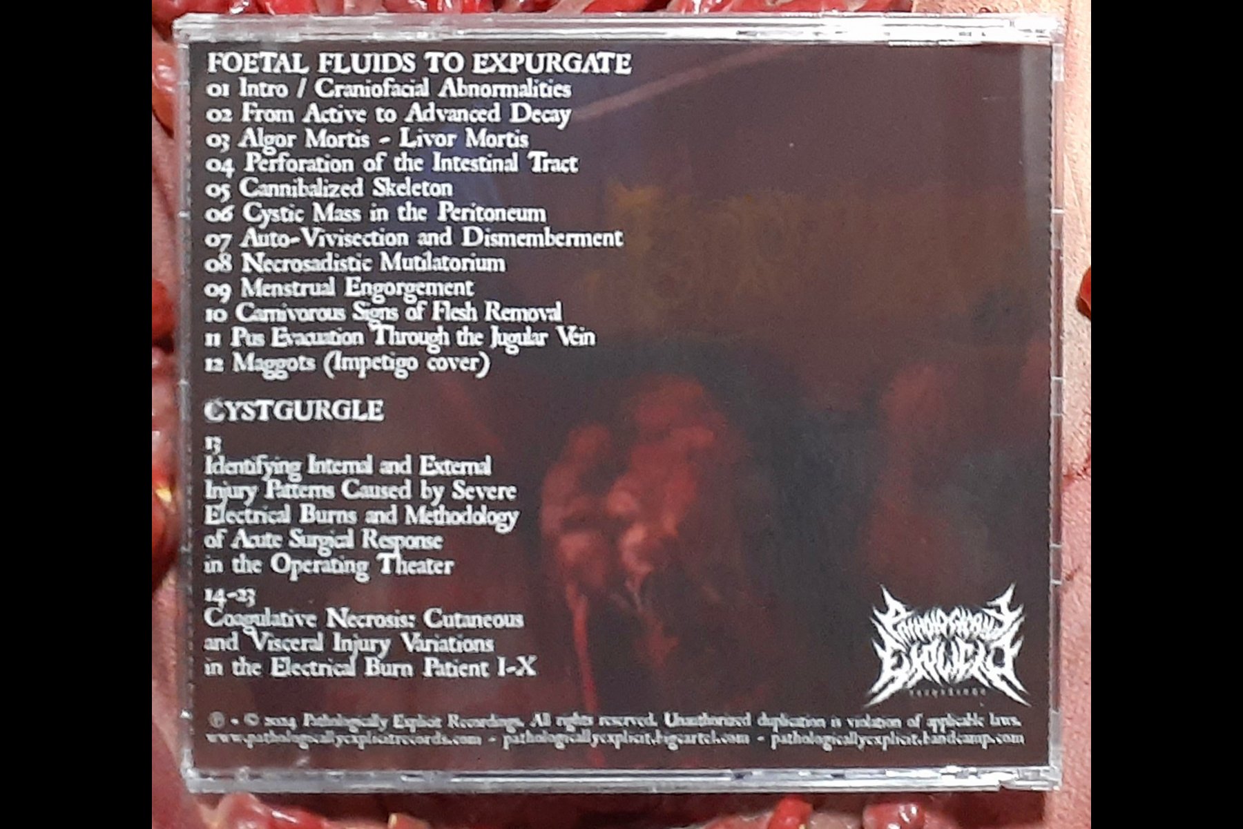 CYSTGURGLE FOETAL FLUID TO EXPURGATE SPLIT CD BACK.jpg
