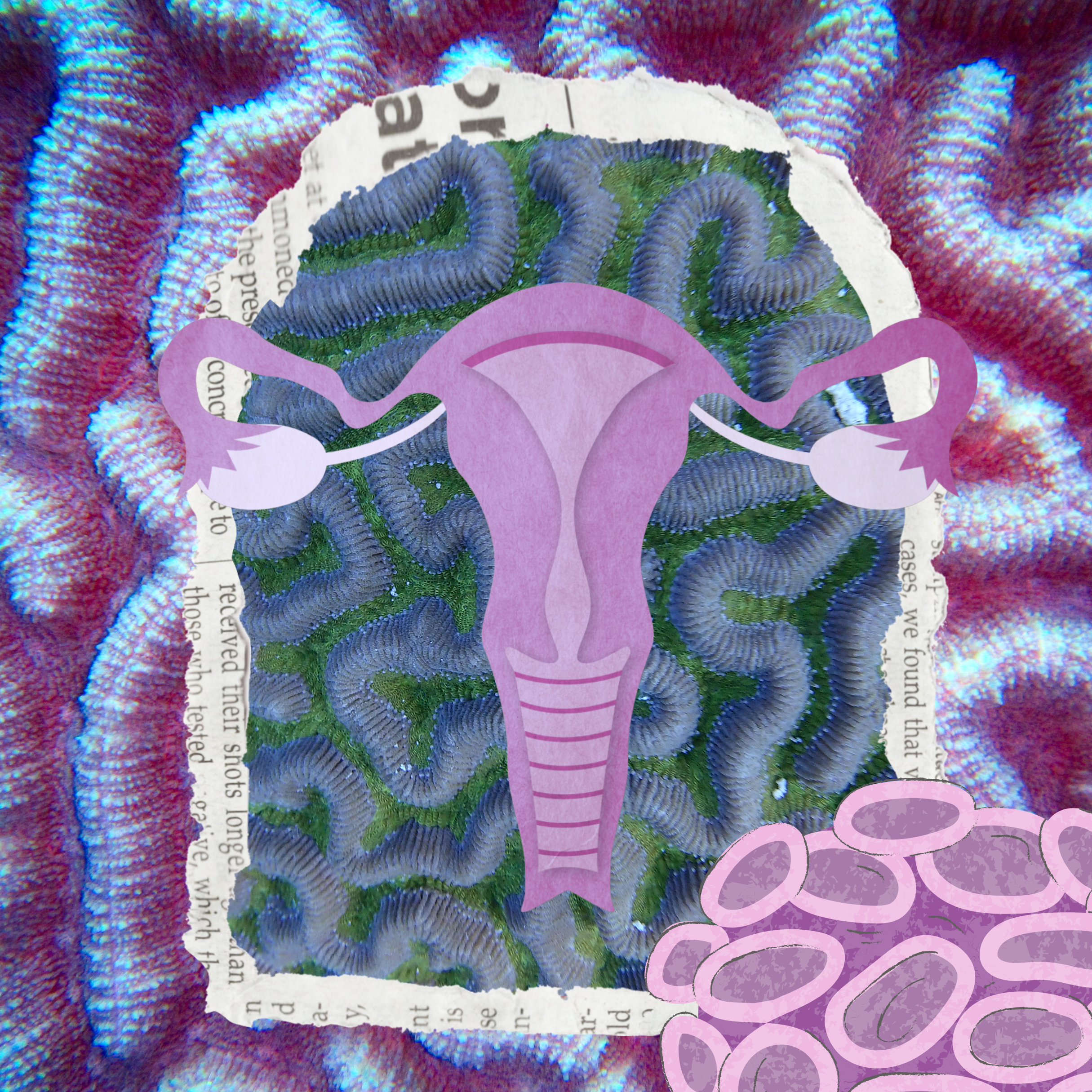 2 Fibroids.png
