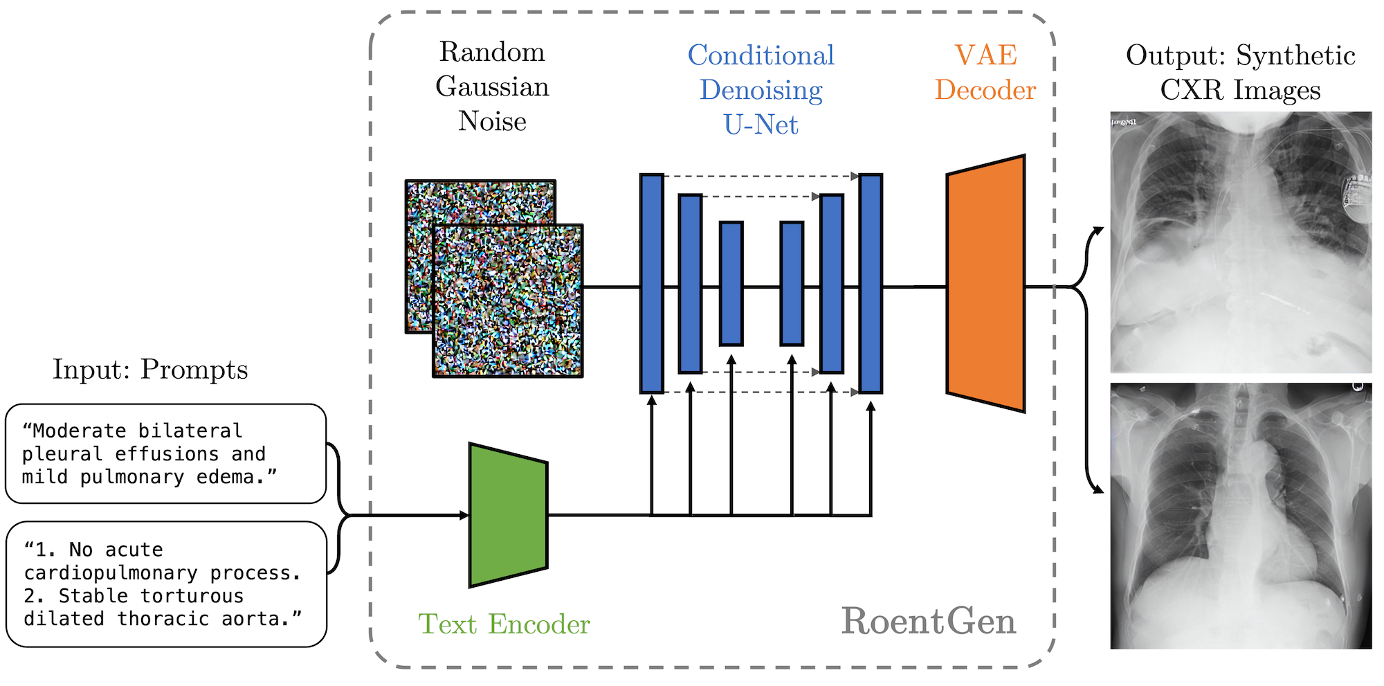 RoentGen: Vision-Language Foundation Model for Chest X-ray Generation