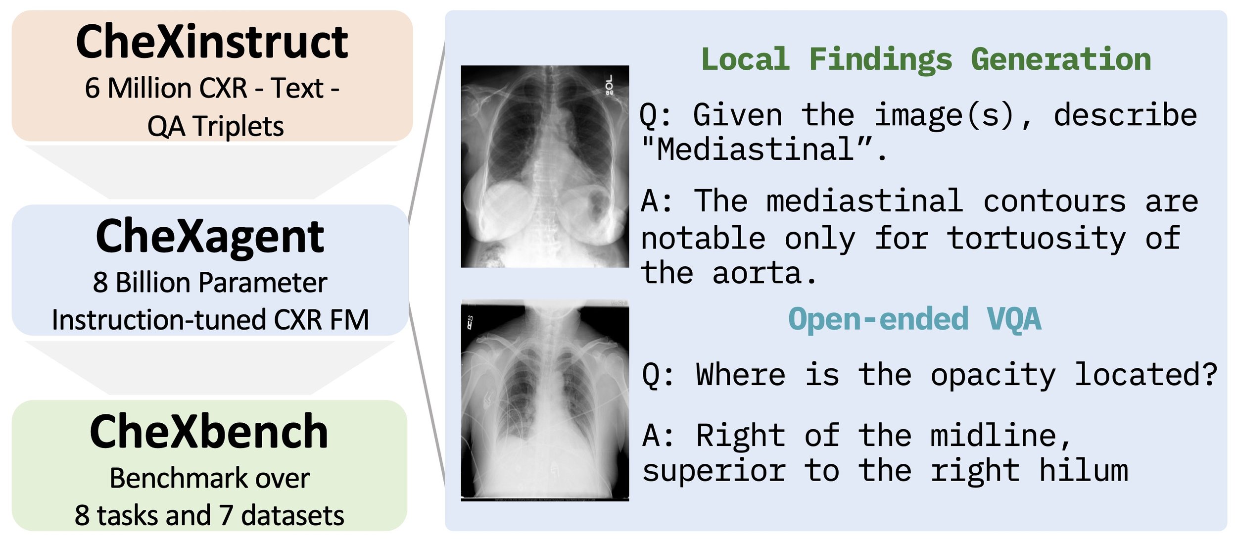 CheXagent: Towards a Foundation Model for Chest X-Ray Interpretation