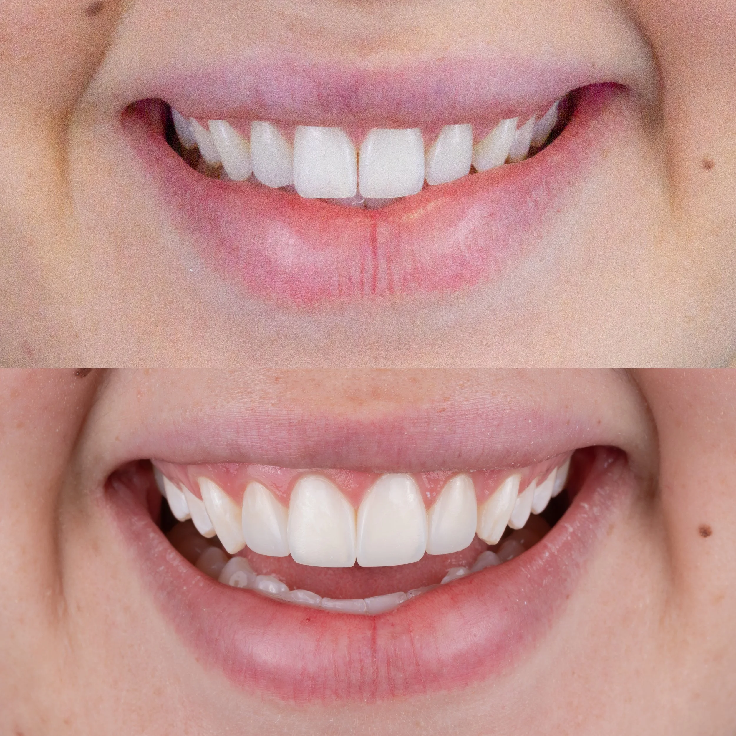 Cosmetic Dentists Ace Dental Studio Gold Coast