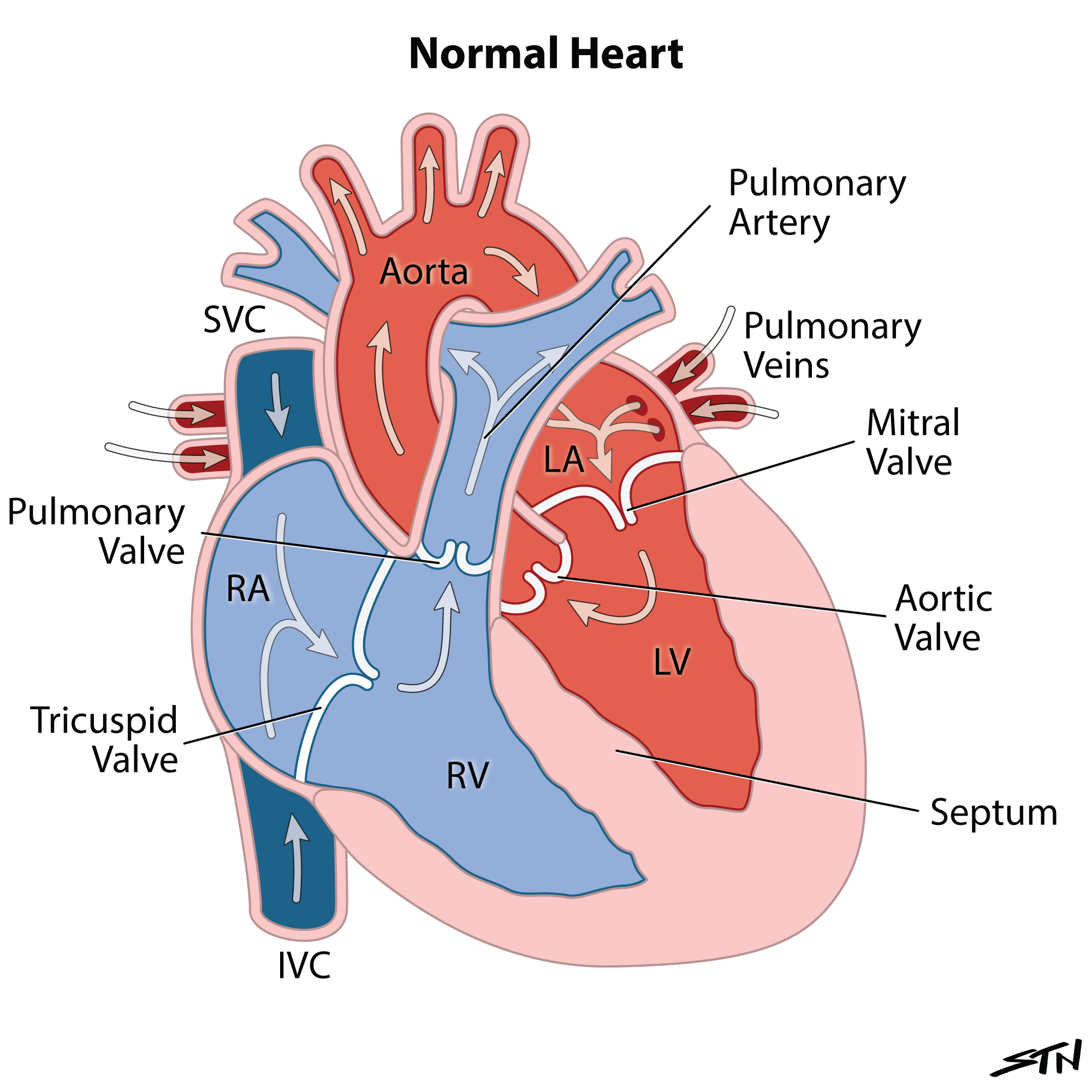 Pediatric Heart Illustrations