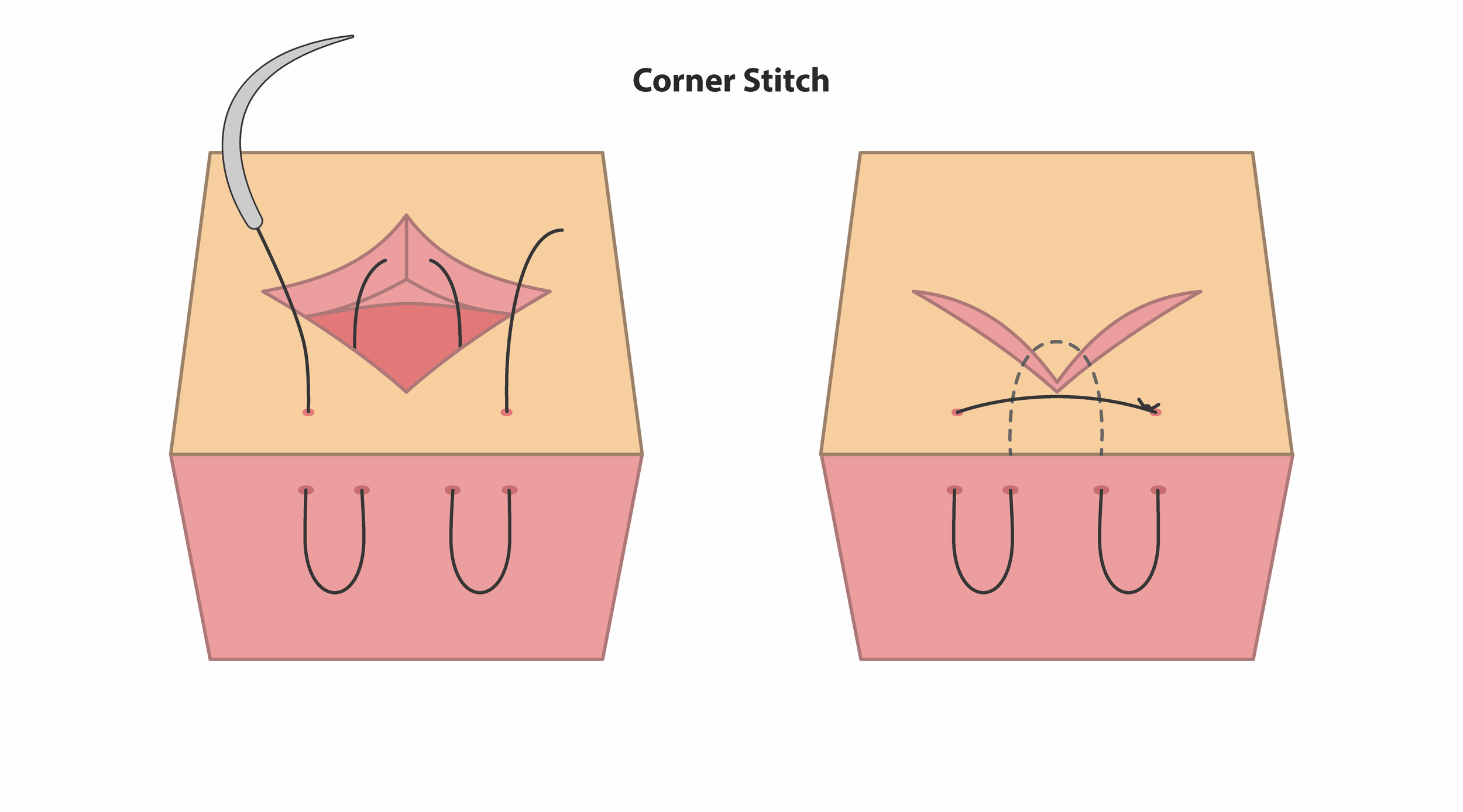Corner Stitch