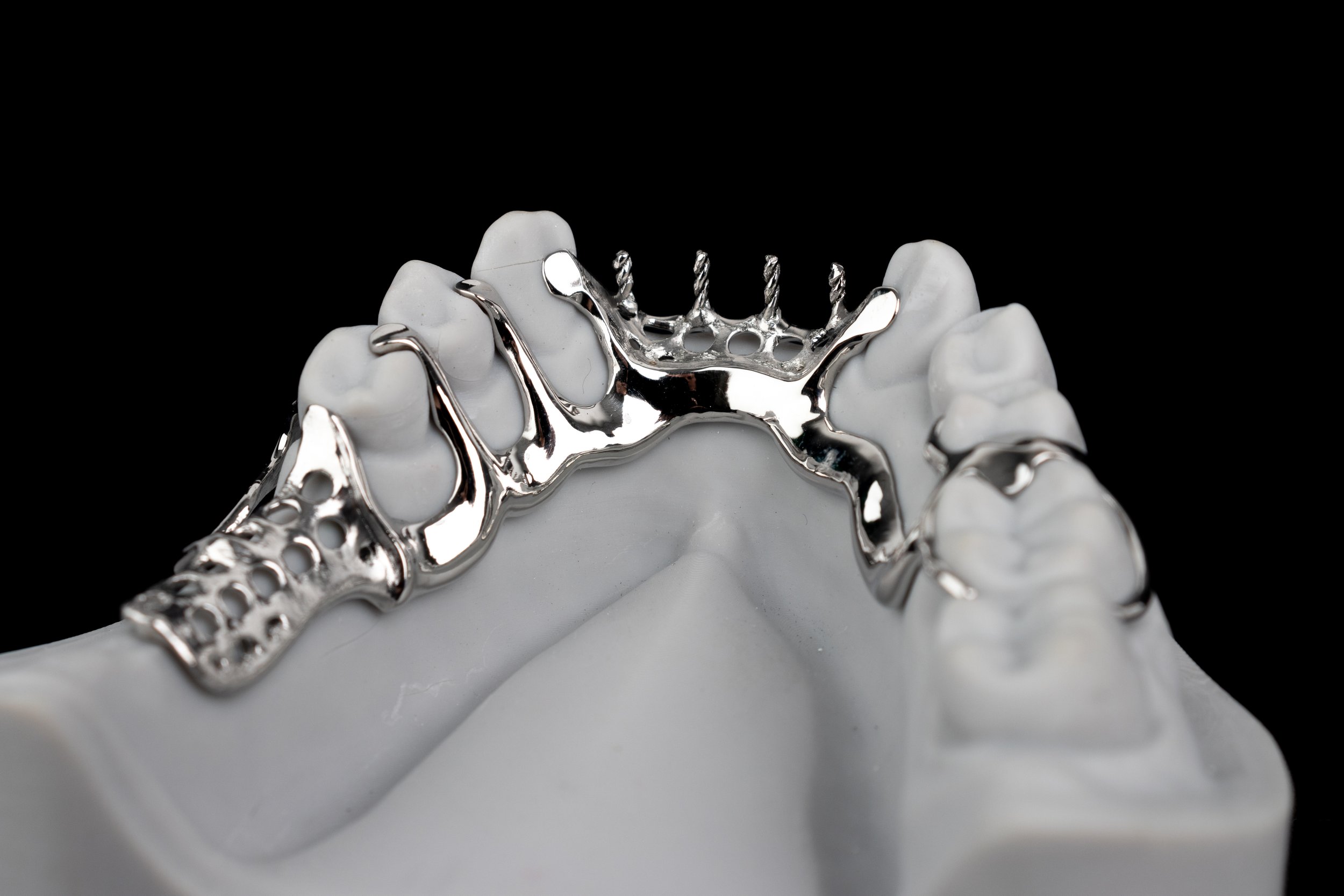 Chrome Cobalt Denture Supply in KL Malaysia — Best Dental Lab Malaysia