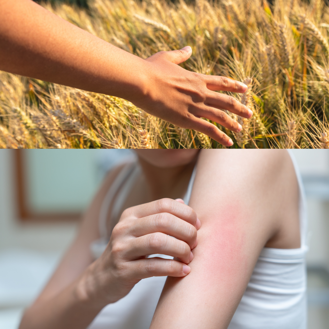 Understanding Food Sensitivities and Their Impact on Health