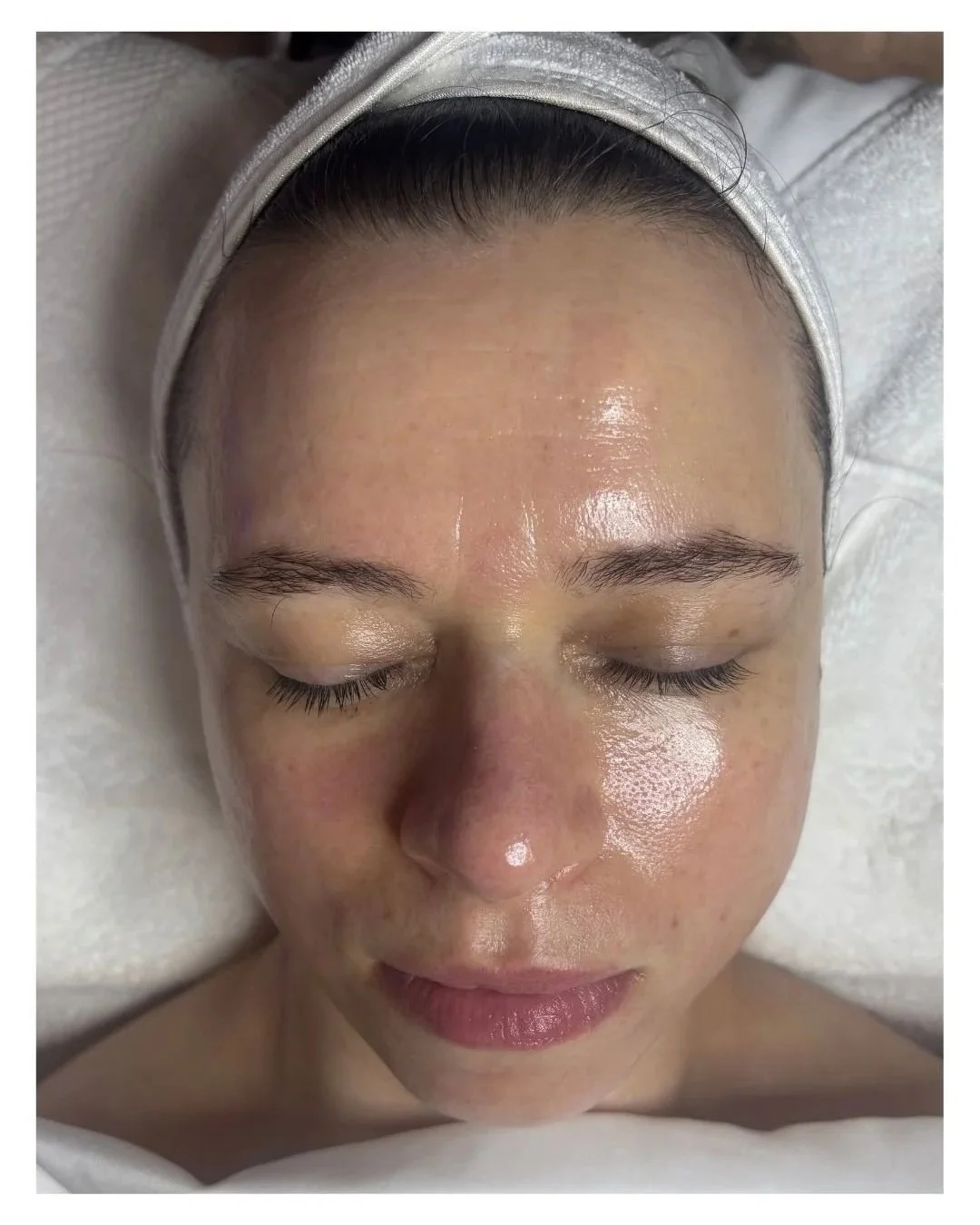 Is Hydrafacial Worth the Hype? Let’s Talk Glow.