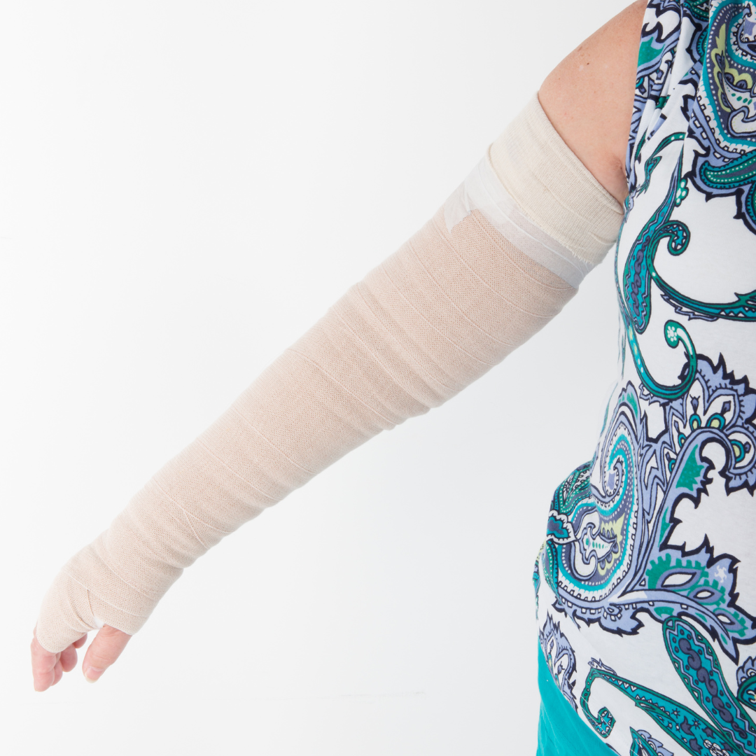 Lymphedema Education: Specialty Store Helps Post-Surgery Patients