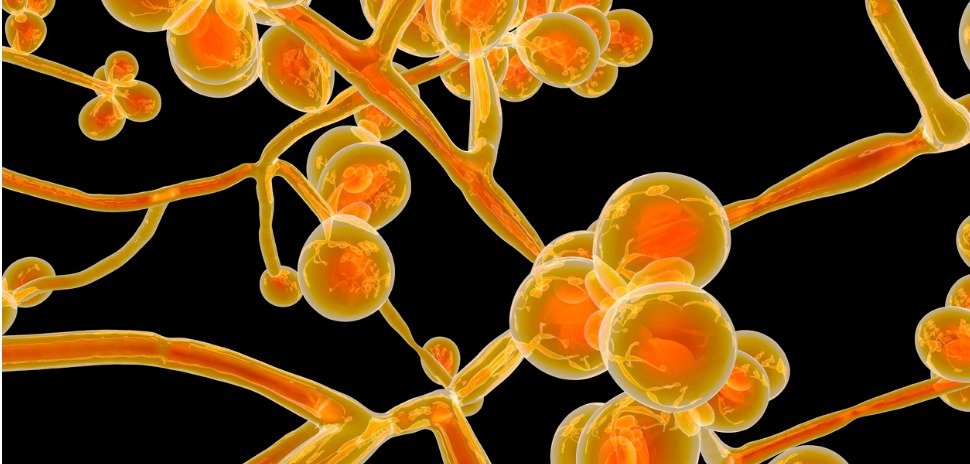 Fatal Yeast: Carrollton Startup MycoDART Steps Up to Fight Infections in Hospitalized Patients
